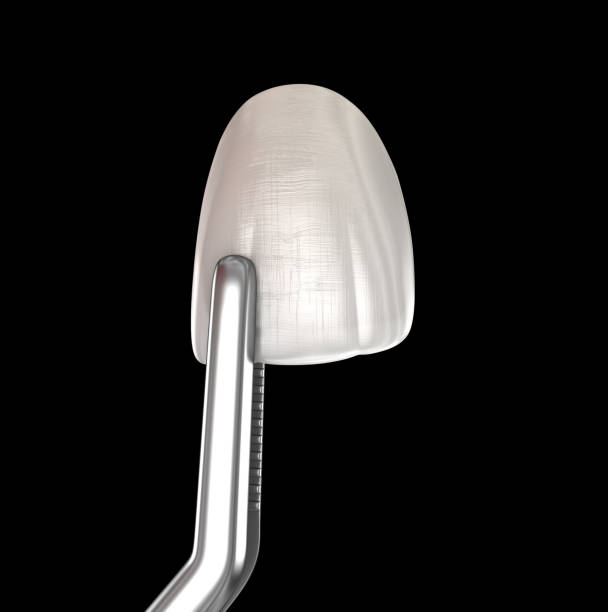 Dental Veneers Milton Keynes Wilson House Dental Practice