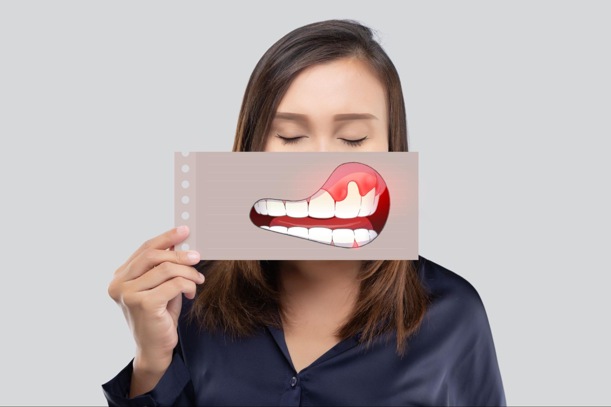 How To Cure Gum Disease Without A Dentist 7 Steps Wilson House