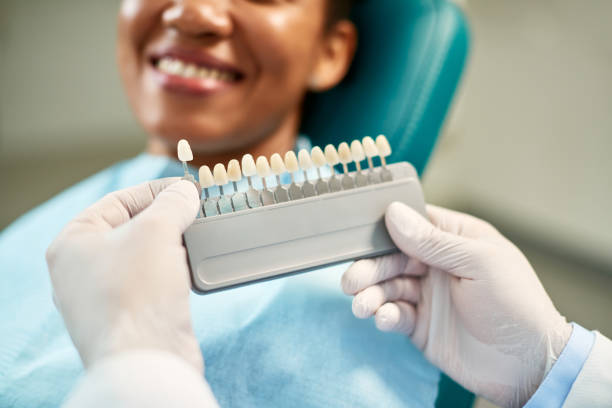 Dental shade guide held up to compare tooth colour with a smiling patient